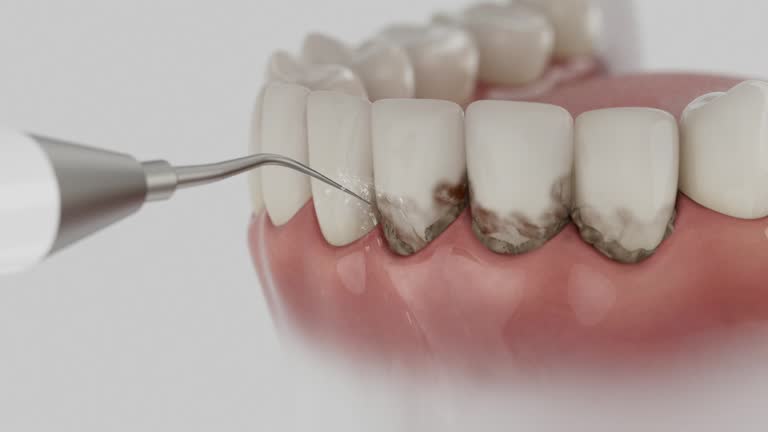 Reliable Wisdom Tooth Removal contractor in Pickett County County, TN by Dentist Open Now